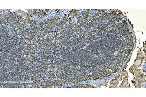 IHC analysis of CD20/MS4A1 using anti-CD20/MS4A1 antibody (ABIN7599233). (CD20 Antikörper  (AA 1-297))