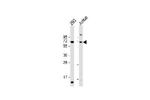All lanes : Anti-CYP2B6 Antibody (Center) at 1:2000 dilution Lane 1: 293 whole cell lysate Lane 2: Jurkat whole cell lysate Lysates/proteins at 20 μg per lane. (CYP2B6 Antikörper  (AA 235-263))