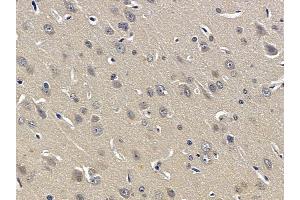 ABIN6257961 and ABIN6274900 at 1/100 staining rat liver tissue by IHC-P.