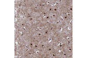 Immunohistochemical staining of human cerebral cortex with RAVER2 polyclonal antibody  shows strong nuclear positivity in neuronal cells and glial cells at 1:50-1:200 dilution.