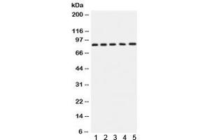 Western blot testing of 1) rat brain, 2) rat testis, 3) human SGC-7901, 4) 22RV1 and 5) MCF7 lysate with APLP1 antibody. (APLP1 Antikörper)