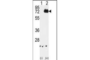 Western blot analysis of IKKalpha (arrow) using rabbit polyclonal IKKalpha Antibody (ABIN6243793 and ABIN6579033). (IKK alpha Antikörper)