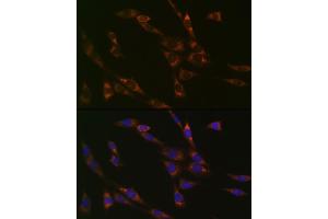 Immunofluorescence analysis of NIH-3T3 cells using RPS3 Rabbit mAb (ABIN7270025) at dilution of 1:100 (40x lens). (RPS3 Antikörper)