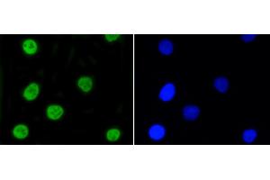 A549 cells were stained with Nrf2(S40) (7G4) Monoclonal Antibody  at [1:200] incubated overnight at 4C, followed by secondary antibody incubation, DAPI staining of the nuclei and detection. (NRF2 Antikörper  (pSer40))