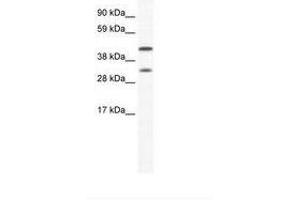 Image no. 1 for anti-Gap Junction Protein, alpha 1, 43kDa (GJA1) (AA 91-140) antibody (ABIN6736018) (Connexin 43/GJA1 Antikörper  (AA 91-140))