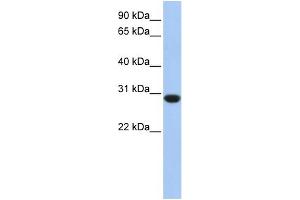 WB Suggested Anti-ASB12 Antibody Titration: 0. (ASB12 Antikörper  (C-Term))