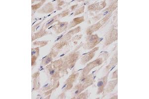 Immunohistochemistry (Paraffin-embedded Sections) (IHC (p)) image for anti-GABA(A) Receptor-Associated Protein (GABARAP) (AA 1-30) antibody (ABIN388564)