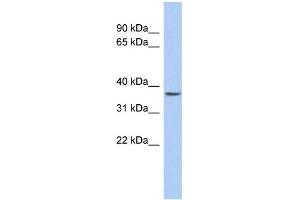 WB Suggested Anti-FOXE3 Antibody Titration: 0. (FOXE3 Antikörper  (N-Term))