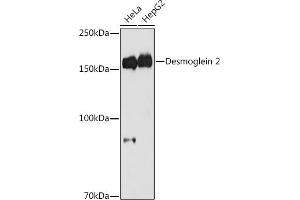 Western blot analysis of extracts of various cell lines, using Desmoglein 2 antibody (ABIN7266740) at 1:1000 dilution. (Desmoglein 2 Antikörper)