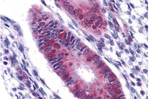 Immunohistochemistry (IHC) image for anti-DEAD (Asp-Glu-Ala-Asp) Box Polypeptide 5 (DDX5) (C-Term) antibody (ABIN185199)