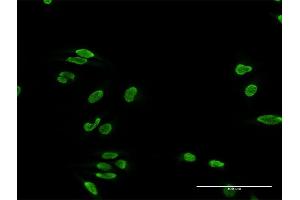 Immunofluorescence of purified MaxPab antibody to TDP1 on HeLa cell. (TDP1 Antikörper  (AA 1-608))