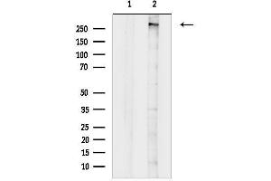 anti-Lysine (K)-Specific Methyltransferase 2B (KMT2B) (C-Term) antibody