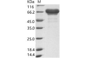Ebola Virus Matrix protein VP40 (EBOV VP40) protein (His tag,MBP tag)