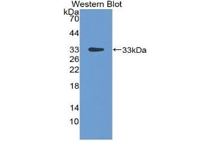 Detection of Recombinant LBP, Rat using Polyclonal Antibody to Lipopolysaccharide Binding Protein (LBP) (LBP Antikörper  (AA 226-480))