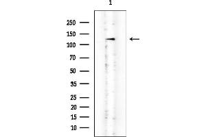 Western blot analysis of lysates from HepG2 cells, using c-Kit Mouse Monoclonal Antibody at 1/1000 dilution.