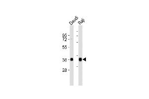 Western Blotting (WB) image for anti-Major Histocompatibility Complex, Class II, DQ alpha 1 (HLA-DQA1) (AA 188-222), (C-Term) antibody (ABIN6243691)