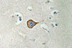 Immunohistochemistry (IHC) analyzes of CNPase antibody in paraffin-embedded human brain tissue. (Cnpase Antikörper)