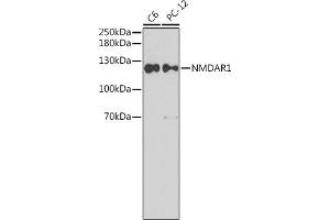 Western blot analysis of extracts of various cell lines, using NMD antibody (ABIN6133732, ABIN6141399, ABIN6141402 and ABIN7101806). (GRIN1/NMDAR1 Antikörper  (AA 600-700))