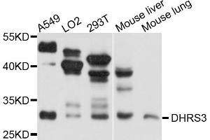 Western blot analysis of extracts of A375 cell line, using DHRS3 antibody. (DHRS3 Antikörper)