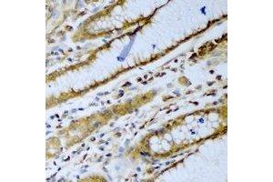 Immunohistochemical analysis of beta-TrCP staining in human stomach formalin fixed paraffin embedded tissue section. (beta-TrCP Antikörper)