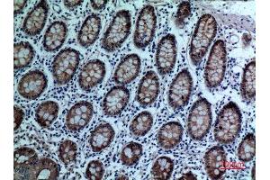 Immunohistochemistry (IHC) analysis of paraffin-embedded Human Colon, antibody was diluted at 1:100.