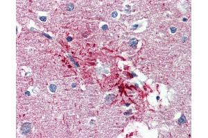 Anti-HMGN1 antibody IHC of human brain, cortex, senile plaque. (HMGN1 Antikörper  (AA 36-85))
