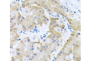 Immunohistochemistry of paraffin-embedded Human stomach using HDAC3 Polyclonal Antibody at dilution of 1:100 (40x lens). (HDAC3 Antikörper)