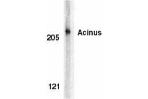 Western blot analysis of acinus in K562 whole cell lysate with AP30013PU-N Acinus antibody at 1 μg/ml. (ACIN1 Antikörper)