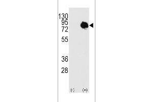 Western blot analysis of TGM2 using rabbit polyclonal using 293 cell lysates (2 ug/lane) either nontransfected (c) or transiently transfected with the TGM2 gene (Lane 2). (Transglutaminase Antikörper  (AA 413-442))