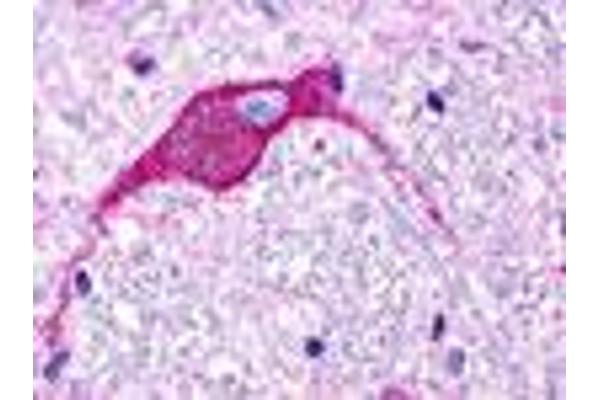 GPR174 Antikörper  (Extracellular Domain)