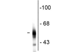 Western Blot - Mouse Anti-Tubulin B III antibody Western Blot of Mouse Anti-Tubulin ß III antibody. (TUBB3 Antikörper)