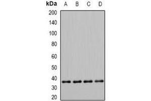 Western blot analysis of PDHB expression in Hela (A), Jurkat (B), mouse skeletal muscle (C), rat heart (D) whole cell lysates. (PDHB Antikörper)
