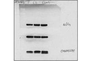 Western Blotting (WB) image for anti-GABA(A) Receptor-Associated Protein (GABARAP) (AA 1-31), (N-Term) antibody (ABIN1449614)