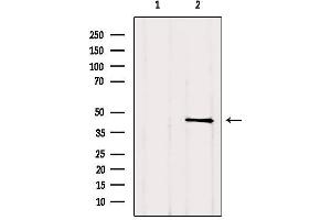 Western blot analysis of extracts from Hela, using TGIF1 Antibody. (TGIF1 Antikörper  (C-Term))