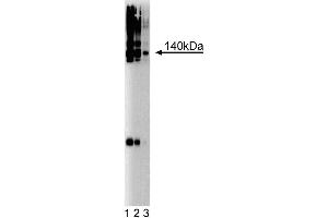 Western blot analysis of Brevican on a rat cerebrum lysate.