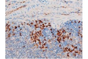Immunohistochemistry (IHC) image for anti-Spleen tyrosine Kinase (SYK) (pTyr348) antibody (ABIN6255895)