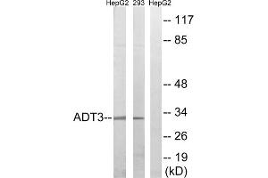Western blot analysis of extracts from HepG2 cells and 293 cells, using SLC25A6 antibody. (SLC25A6 Antikörper  (Internal Region))