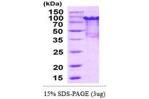 Protein Arginine Methyltransferase 1 (PRMT1) (AA 1-353) (Active) protein (His-MBP)