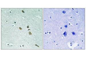 Immunohistochemistry (IHC) image for anti-Integrin-Linked Kinase (ILK) (Ser246) antibody (ABIN1848219) (ILK Antikörper  (Ser246))