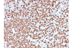 Formalin-fixed, paraffin-embedded human Spleen stained with CD74 Mouse Monoclonal Antibody (LN-2). (CD74 Antikörper)