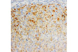 Anti-FGF8 antibody, IHC(P) IHC(P): Rat Ovary Tissue