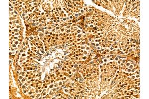 ABIN7094313 and ABIN7098360 at 1/100 staining Mouse testis tissue by IHC-P. (IWS1 Antikörper  (N-Term))