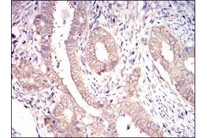 Immunohistochemistry (IHC) image for anti-Eukaryotic Translation Initiation Factor 2A, 65kDa (EIF2A) (AA 448-576) antibody (ABIN1724939)