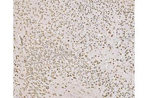 IHC analysis of SND1 using anti-SND1 antibody (ABIN7600525). (SND1 Antikörper  (AA 20-204))