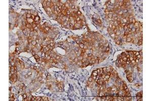 Image no. 2 for anti-Eukaryotic Translation Initiation Factor 4 gamma 3 (EIF4G3) (AA 1-516) antibody (ABIN599055) (EIF4G3 Antikörper  (AA 1-516))