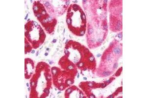 Immunohistochemical analysis of Aquaporin 2 staining in human kidney formalin fixed paraffin embedded tissue section. (AQP2 Antikörper  (C-Term))