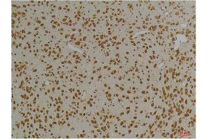 Immunohistochemistry (IHC) image for anti-Potassium Voltage-Gated Channel, Subfamily H (Eag-Related), Member 1 (KCNH1) antibody (ABIN3181693)