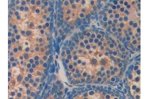 Detection of AGRP in Mouse Testis Tissue using Polyclonal Antibody to Agouti Related Protein (AGRP)