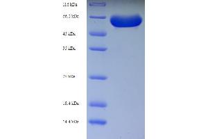 SDS-PAGE (SDS) image for Receptor-Interacting Serine-threonine Kinase 2 (RIPK2) (AA 1-540), (full length) protein (His tag) (ABIN5710260) (RIPK2 Protein (AA 1-540, full length) (His tag))