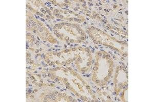 Immunohistochemistry of paraffin-embedded human kidney using BCL2L1 antibody at dilution of 1:200 (x400 lens) (BCL2L1 Antikörper  (AA 1-120))